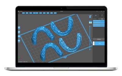 Chitubox Slicer on a laptop screen showing dental model setup for resin 3D print preparation.